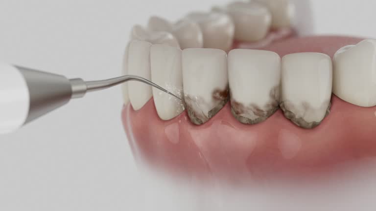 Trusted Teeth Cleaning And Checkup service in Urbancrest, OH - Dentist Open Now